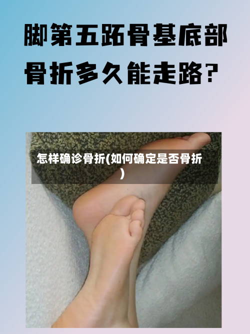 怎样确诊骨折(如何确定是否骨折)