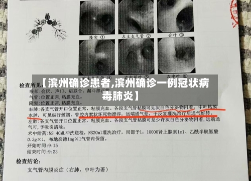 【滨州确诊患者,滨州确诊一例冠状病毒肺炎】