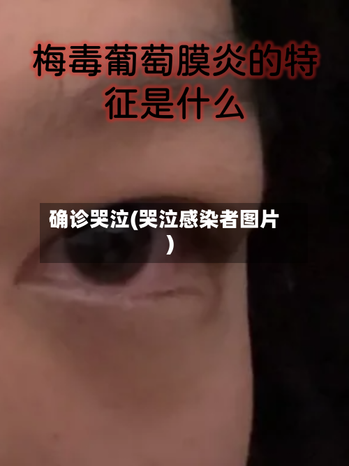 确诊哭泣(哭泣感染者图片)