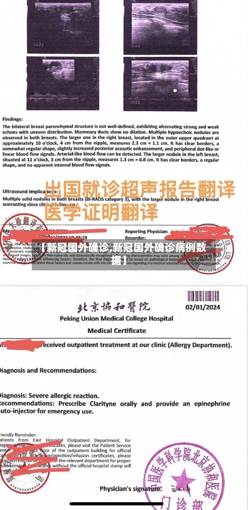 【新冠国外确诊,新冠国外确诊病例数据】-第2张图片
