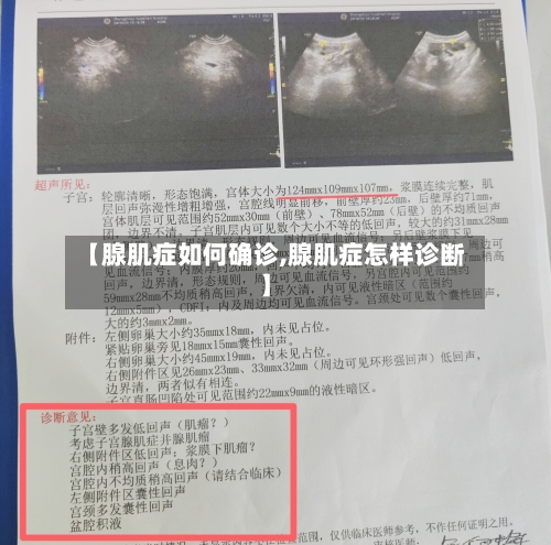 【腺肌症如何确诊,腺肌症怎样诊断】-第2张图片
