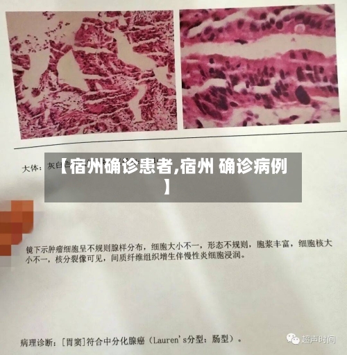【宿州确诊患者,宿州 确诊病例】