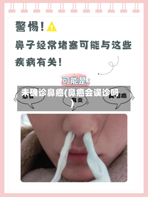 未确诊鼻癌(鼻癌会误诊吗)-第2张图片