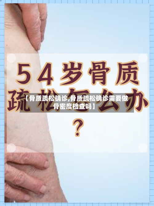 【骨质疏松确诊,骨质疏松确诊需要做骨密度检查吗】