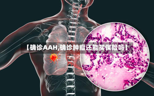 【确诊AAH,确诊肿瘤还能买保险吗】