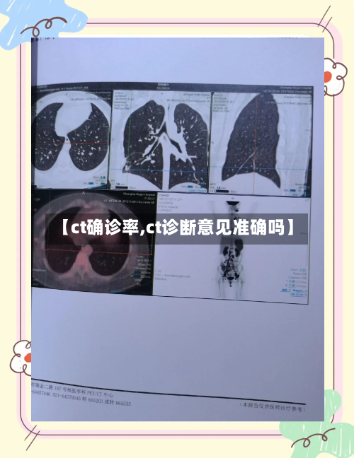 【ct确诊率,ct诊断意见准确吗】-第3张图片