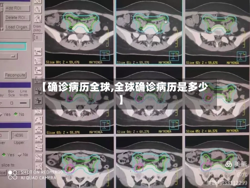 【确诊病历全球,全球确诊病历是多少】-第2张图片