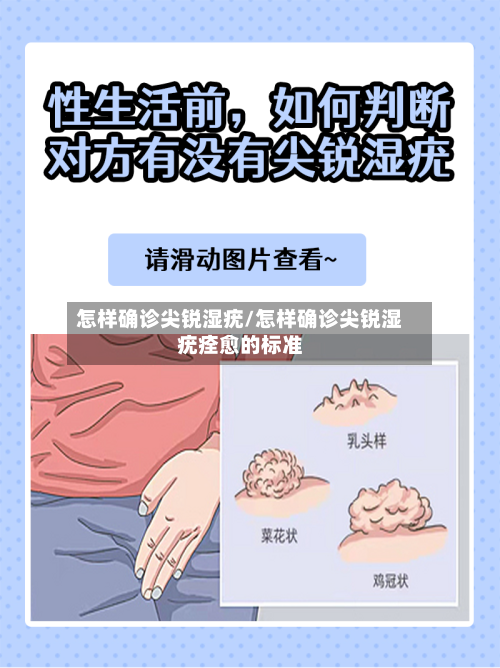 怎样确诊尖锐湿疣/怎样确诊尖锐湿疣痊愈的标准-第3张图片