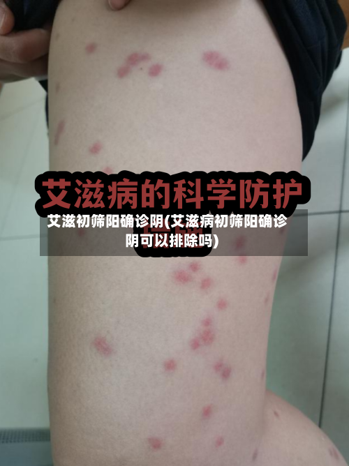 艾滋初筛阳确诊阴(艾滋病初筛阳确诊阴可以排除吗)-第2张图片