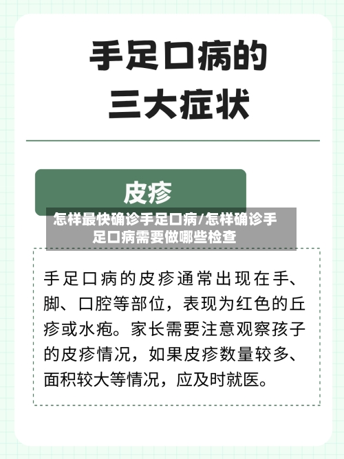 怎样最快确诊手足口病/怎样确诊手足口病需要做哪些检查