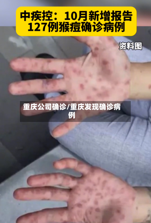 重庆公司确诊/重庆发现确诊病例-第3张图片