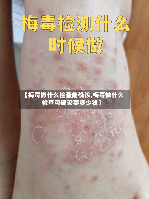 【梅毒做什么检查能确诊,梅毒做什么检查可确诊要多少钱】-第2张图片