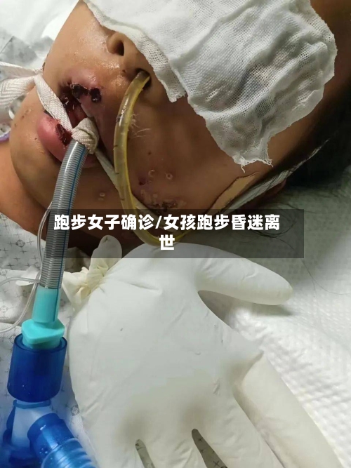 跑步女子确诊/女孩跑步昏迷离世-第3张图片