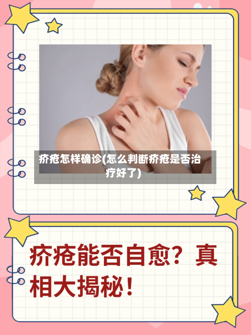 疥疮怎样确诊(怎么判断疥疮是否治疗好了)-第2张图片