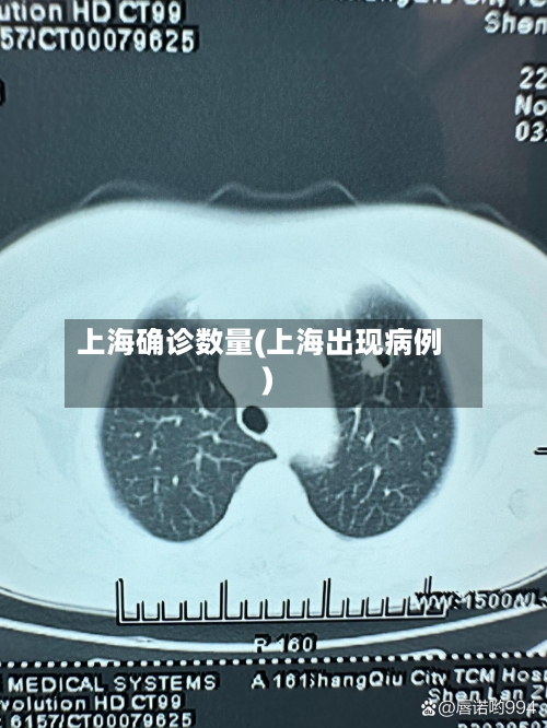 上海确诊数量(上海出现病例)-第3张图片