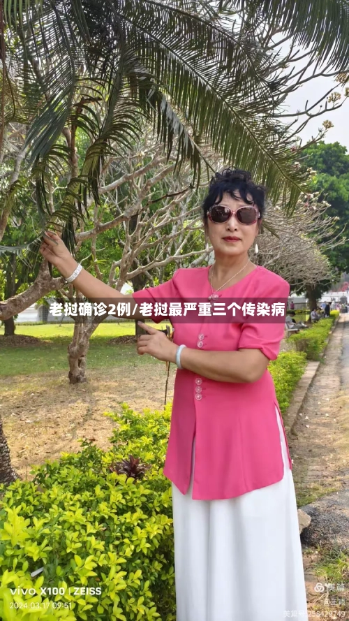 老挝确诊2例/老挝最严重三个传染病