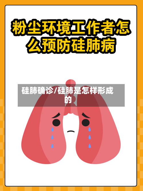硅肺确诊/硅肺是怎样形成的