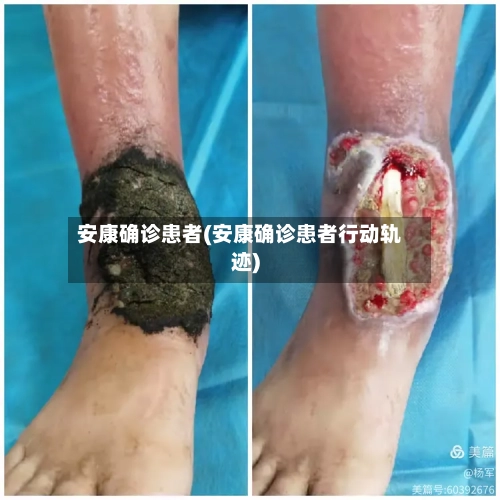 安康确诊患者(安康确诊患者行动轨迹)