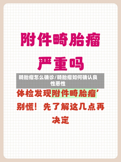 畸胎瘤怎么确诊/畸胎瘤如何确认良性恶性-第2张图片